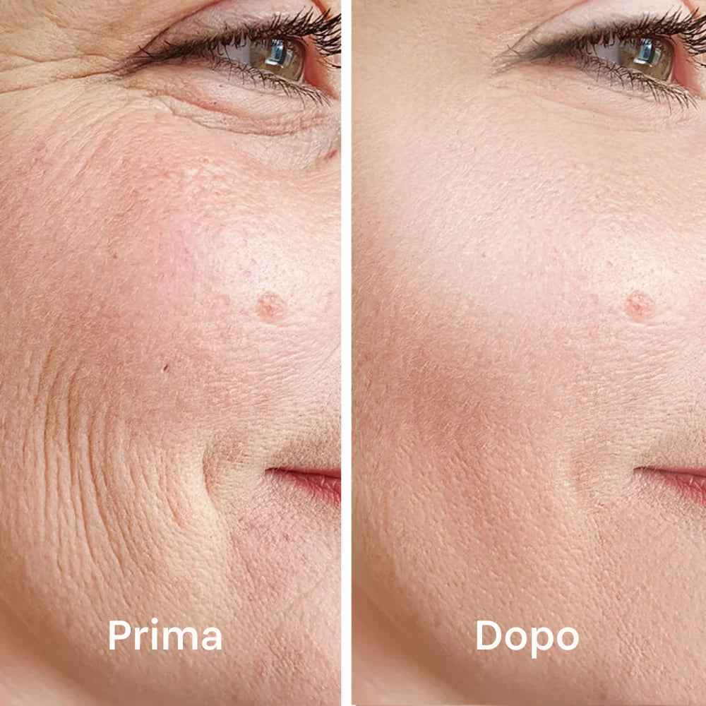 Maschera Lifting V-Line – Rassoda e Ringiovanisce